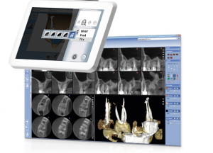 Planmeca 3 D scanner