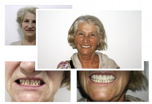 cosemtic-dentistry